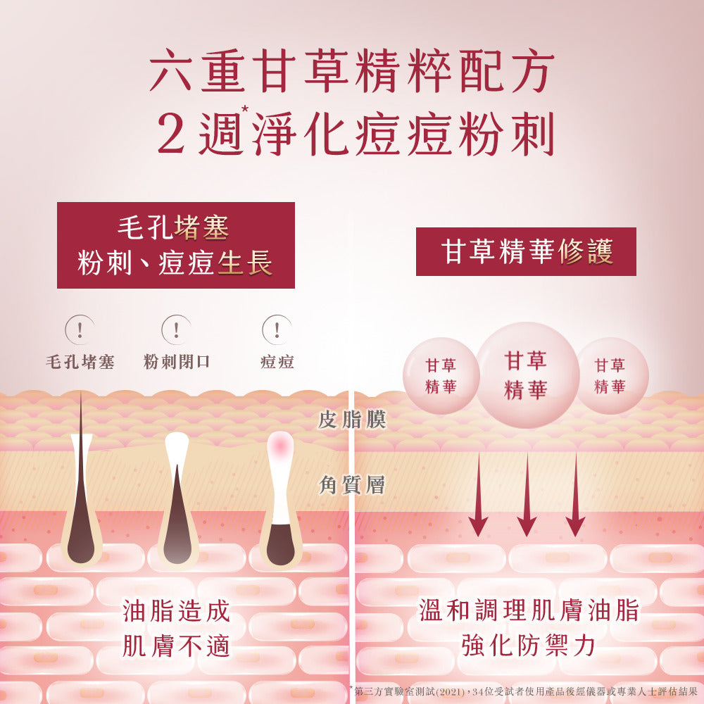 TUNEMAKERS 油水平衡甘草美容液 30ml